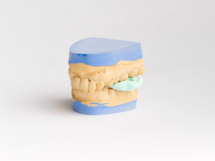 The Raw Morphology